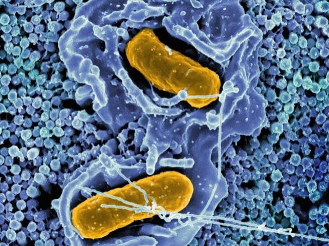 Kunnen condooms schimmelinfecties veroorzaken?