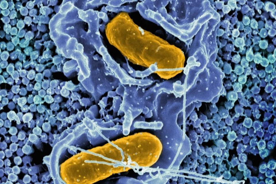 Kunnen condooms schimmelinfecties veroorzaken?