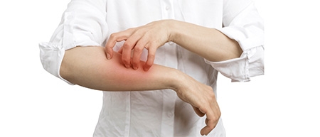 Latexallergie is een allergie voor latex, een allergische reactie, niet voor de latex zelf, maar voor producten die latex bevatten. Latexbevattende producten. Vooral bij veel beroepen speelt allergie een grote rol door het gebrek aan geschikte handschoenen, maar ook andere risicogroepen krijgen allergische klachten.